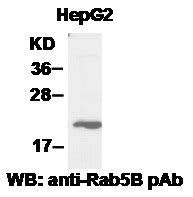 Rab B Pab Neweast Biosciences Gtpase Oncogene And Bioactive Protein