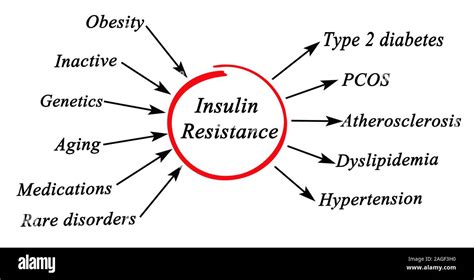 Insulin Resistance Hi Res Stock Photography And Images Alamy