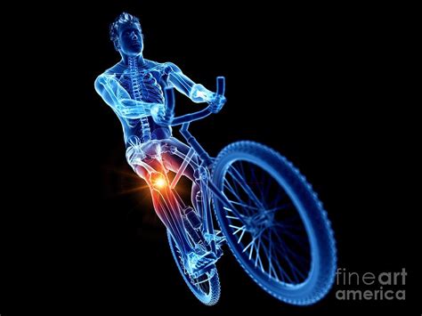 Cyclist With Knee Pain Photograph By Sebastian Kaulitzkiscience Photo