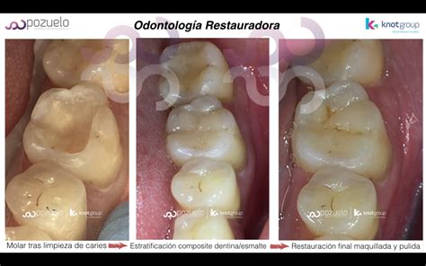 Odontología Restauradora y Estética Dentistas en el Barrio de