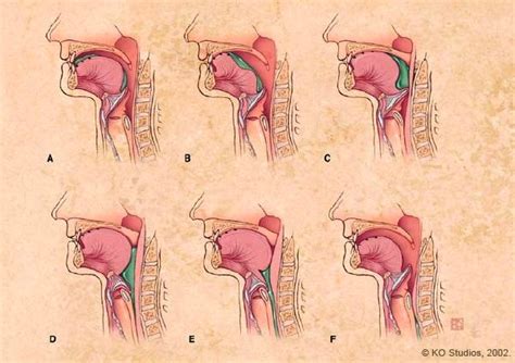 Process Of Swallowing Diagram Normal Swallowing Poster