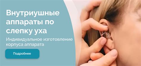 Внутриушные слуховые аппараты - купить в Москве по выгодной цене