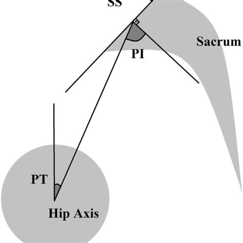 Schematic Diagram Of The Spinopelvic Parameters According To The