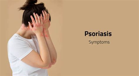 Psoriasis: Symptoms, causes, types & available treatment options