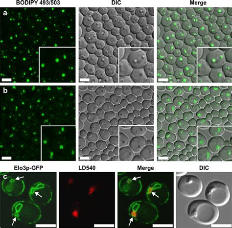 Lipid Droplet Morphology Of Fld1d Cells Depends On Growth Conditions