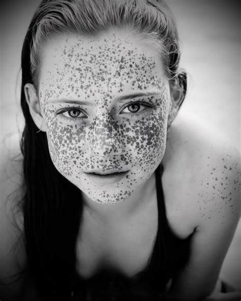 Freckles Веснушки