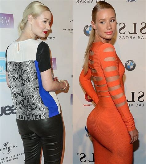 Iggy Azalea before and after alleged butt implants