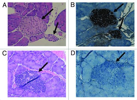 Pancreatic Tissue Showing Islets Stained With H E And Insulin From