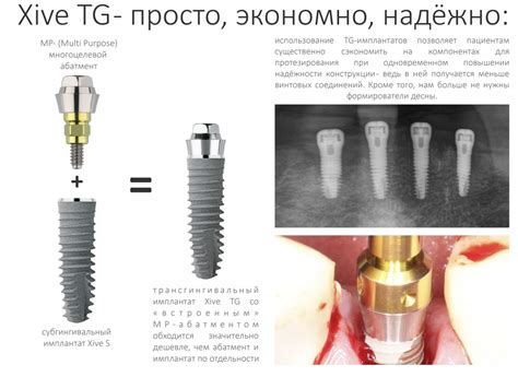 Ортопедическая платформа имплантата — конусы, шестигранники и винты ...