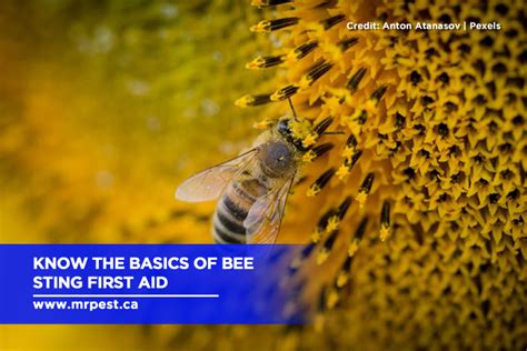 how to treat bee stings at home