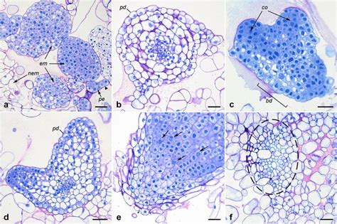 Somatic Embryogenesis In Nigella Damascena From Hypocotyl And