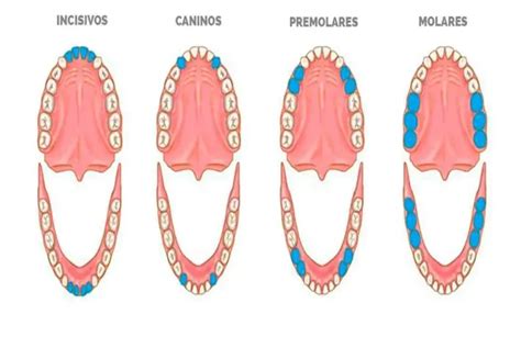 Qué es la mandíbula desviada Clinica Dental Sonrisa Segura