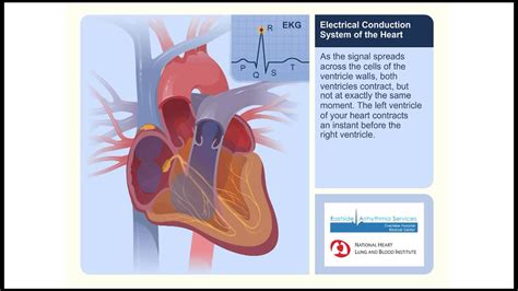 Conduction System Of The Heart Animation