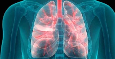 Classification of lung nodules - Lung Nodule