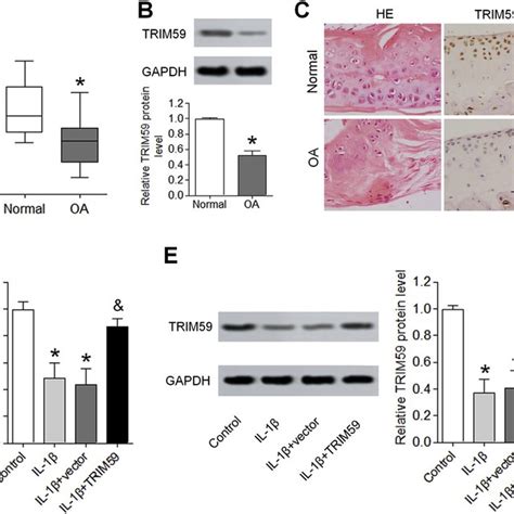 Downregulation Of Trim In Oa Cartilage And Il Betreated