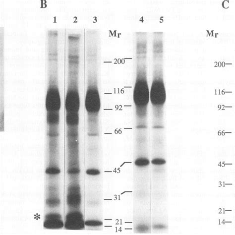 A Autoradiogram Of Northern Blot Analysis Of P Falciparum Hrp Gene