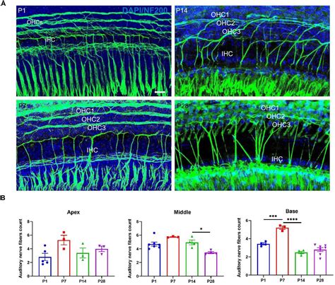 Frontiers Autophagy Mediated Synaptic Refinement And Auditory Neural