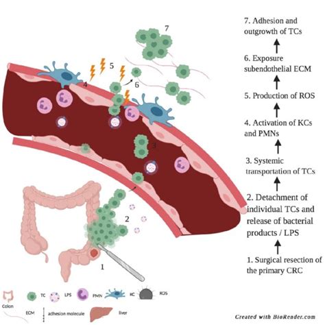 Surgery Induced Liver Metastases Surgical Resection Of The Primary Crc Download Scientific