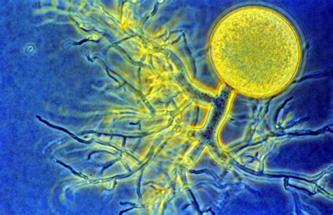 Oh93 Independent Study On Fungi Chytrids