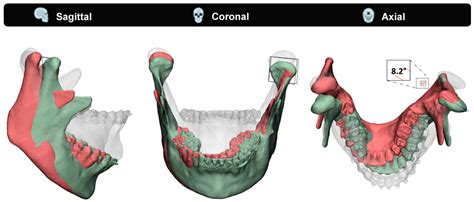 Jpm Free Full Text Four Dimensional Determination Of The Patient