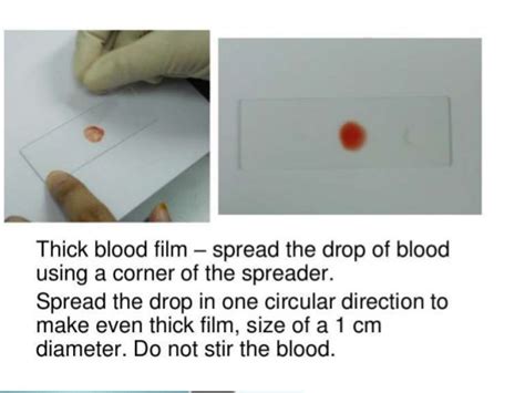 Preparation of peripheral blood flim