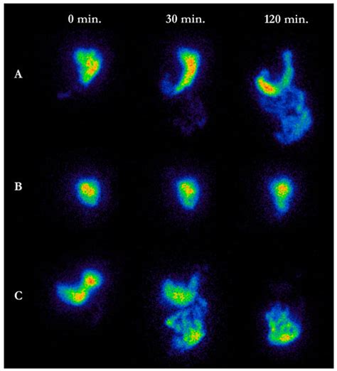 Jcm Special Issue Neurogenic Bowel Dysfunction