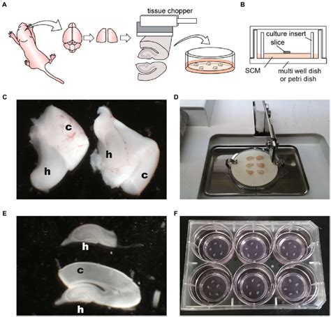 Schematic Diagrams And Photographs Of Procedure For Hippocampal Slice