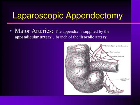 Laparoscopic Appendectomy Anatomy