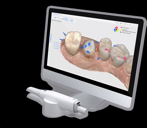 デジタル歯科の進化： 口腔内スキャナーが変える治療の未来｜千歳烏山の歯医者｜千歳烏山6番街歯科