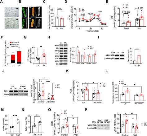 Differential Bioenergetics In Adult Rodent Cardiomyocytes Isolated From