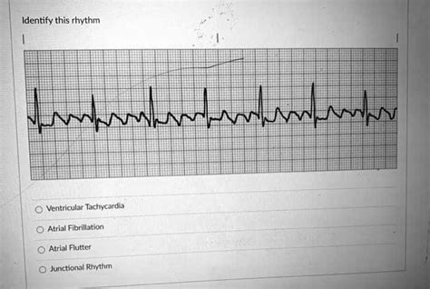 identify  rhythm ventricular tachycardia atrial fibrillation atrial