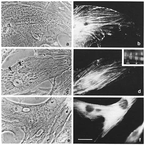 Phase Contrast And Corresponding Fluorescent Images Of Embryonic