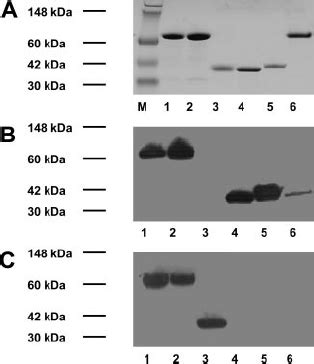 Protein Purification And Western Blotting Of Recombinant Proteins Top