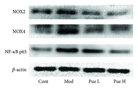 Effect of puerarin on protein expression of NOX2 NOX4 and NF κB p65