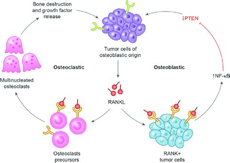 Cellular And Molecular Biology Of Local Osteosarcoma Progression With