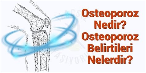 Osteoporoz Nedir La S Z Ya Yoruz