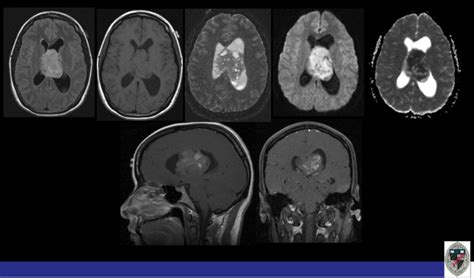 Question 48 MRI Online