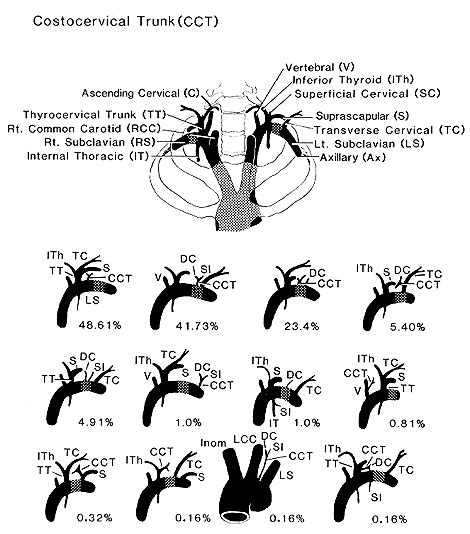 Image Of Costrocervical Trunk