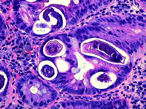 Hematoxylin And Eosin Stain Showing Strongyloides Eggs And Larvae In Download Scientific