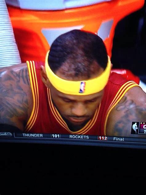 Photo: LeBron James' Hairline Is Looking Really Bad In This Picture