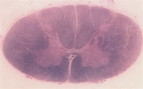 Neuro 3050 - Brainstem as an integrative center: Brainstem nuclei in ...