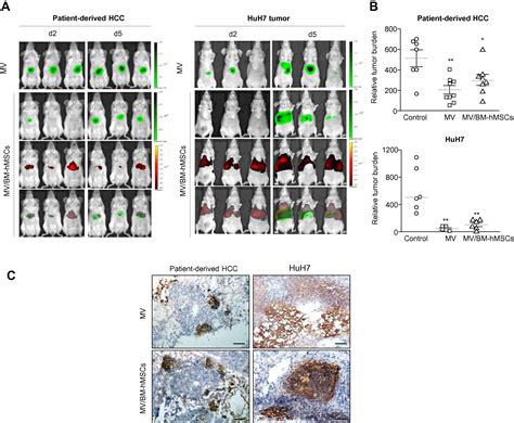 Systemically Delivered Measles Virus Infected Mesenchymal Stem Cells