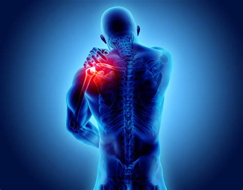 Shoulder Pain Images