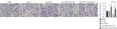 Ev Carried Mir 375 Inhibits The Fibrosis Of Fbmfs Via Targeting Foxf1