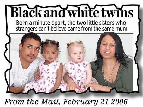 Look At Us Now The Black And White Twins As They Turn Seven Daily Mail Online