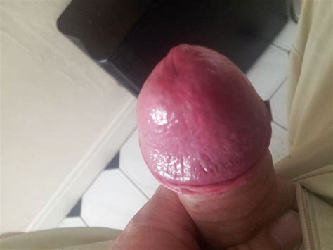 Some More Of My Cock Foreskin Porn Pictures XXX Photos Sex Images 568545 PICTOA