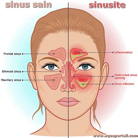 Sinusoïde définition et explications