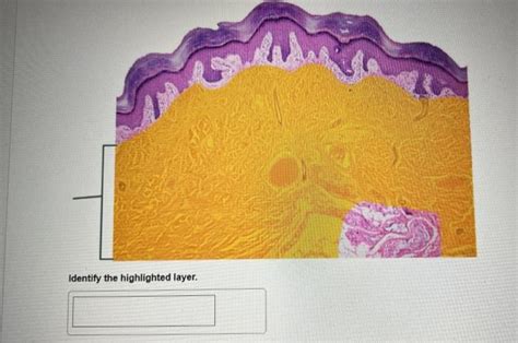 Solved Identify The Highlighted Layer