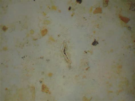 Fotografie parazitů