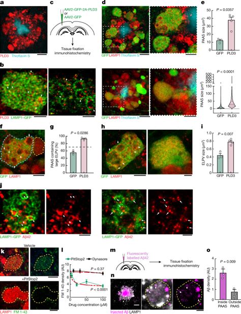 Pld Affects Axonal Spheroids And Network Defects In Alzheimers